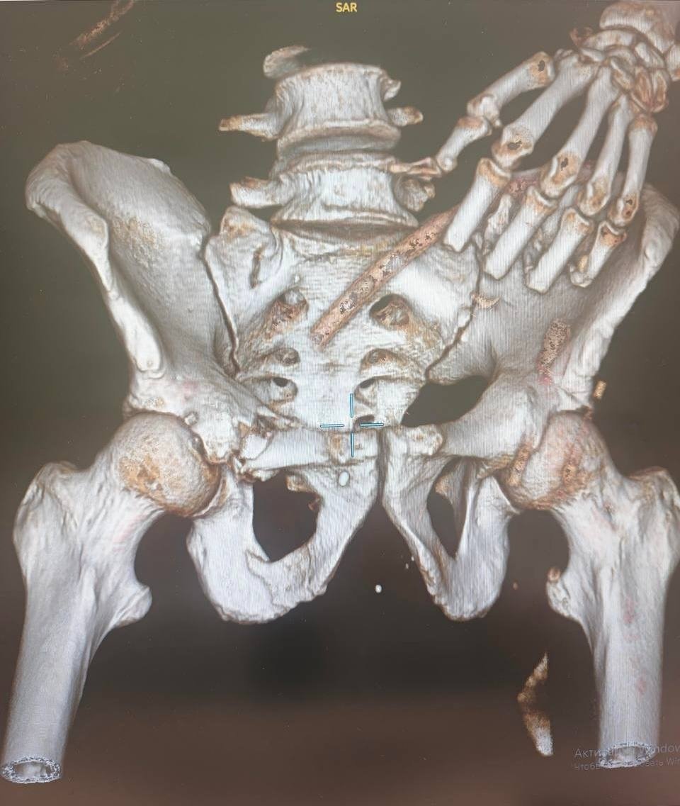 Изображение: НИИ имени Джанелидзе