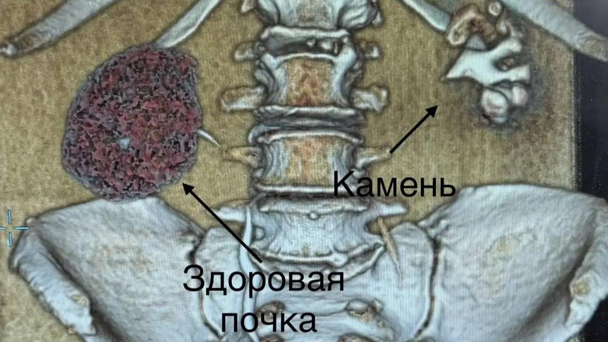 Иллюстрация: «Будни Джанелидзе»