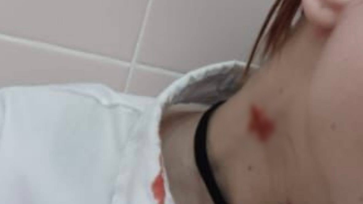 Пятиклассницу увезли в больницу с раной шеи из школы на Тихоокеанской улице