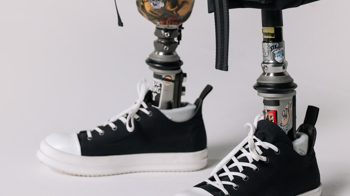 Видео, где школьники задевают сверстника с протезами ног, могло быть постановкой