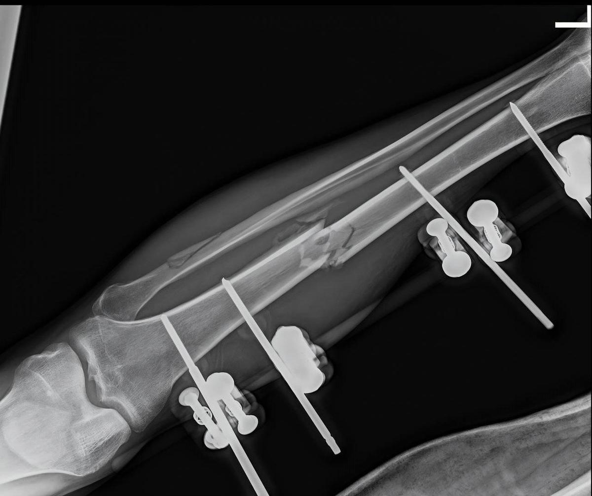 Изображение: НИИ имени Джанелидзе
